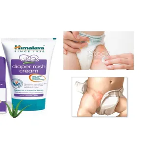 Baby dayper rash crime (50gm)