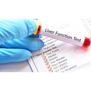 LIVER FUNCTION TEST (LFT)