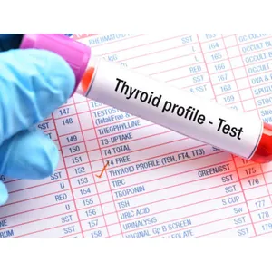 THYROID PROFILE