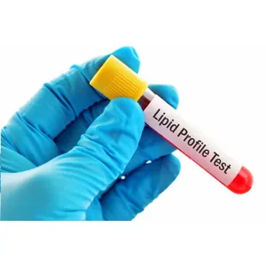 Lipid Profile