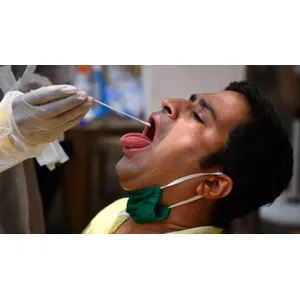 COVID-19  RT-PCR