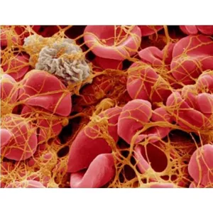 PROTHOMBIN TEST (PT-INR)