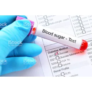 RANDOM BLOOD SUGAR