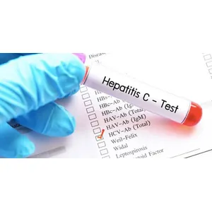 HCV TEST