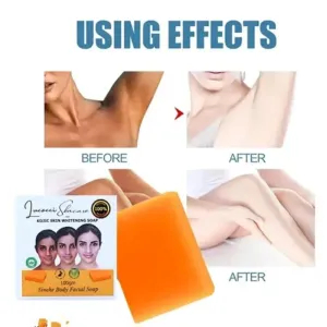 Jiore Skincare Sinche Soap - Natural & Nourishing Kojic Whitening Facial Soap | Gentle Cle