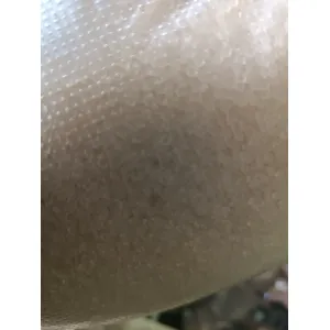  sugar (साखर)