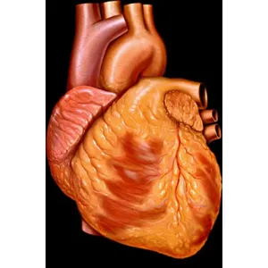 Pro Heart